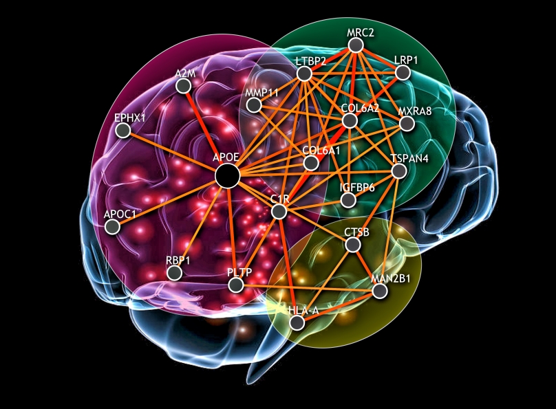 Brain network